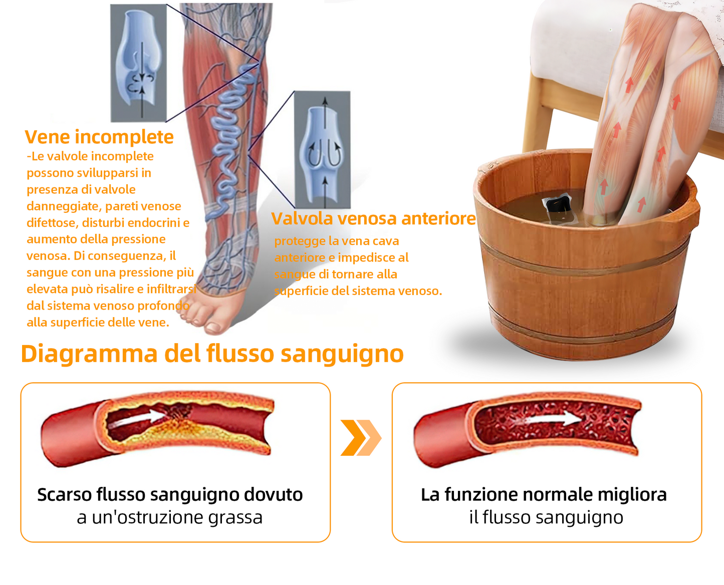 Sono rimaste solo 8 confezioni! Godetevi il 30% di sconto! Gli esperti consigliano di acquistare da 4 a 6 confezioni per un ripristino totale della salute del sistema linfatico. Non perdete questa occasione o dovrete aspettare l'anno prossimo!🦵👩‍⚕️