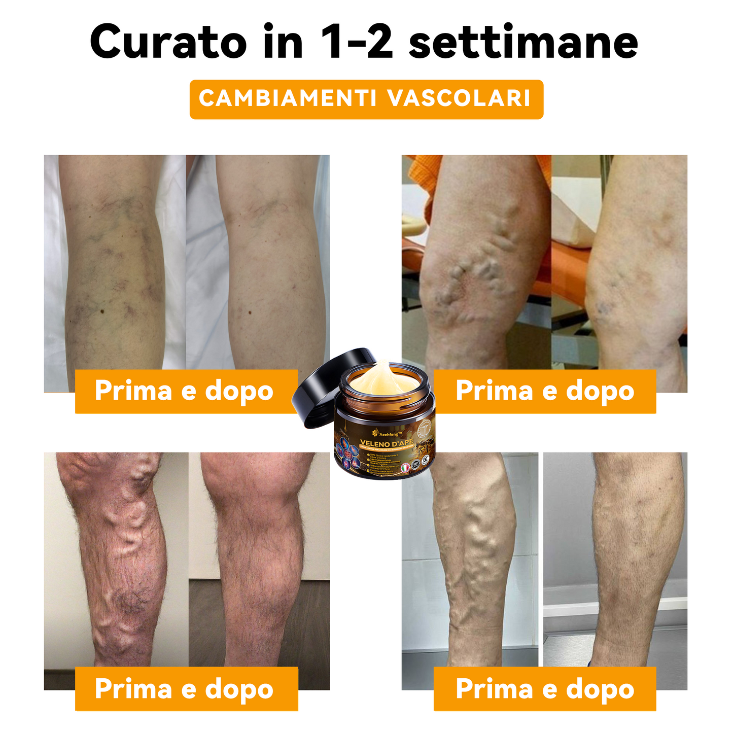 Sono rimaste solo le ultime 10 lattine! Vi offriamo un ulteriore sconto del 30%! Testato da specialisti ortopedici, 4-6 lattine per ritrovare la salute! Se non ci riuscite, dovrete aspettare l'anno prossimo!💯💯