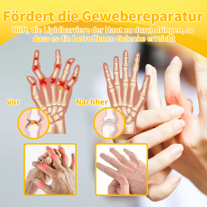 Es sind nur noch 5 Boxen übrig! Genießen Sie 30 % Rabatt!❤️Orthopäden empfehlen den Kauf von 4 bis 6 Boxen, um die Gelenkgesundheit vollständig wiederherzustellen. Verpassen Sie diese Gelegenheit nicht, sonst müssen Sie bis zum nächsten Jahr warten!