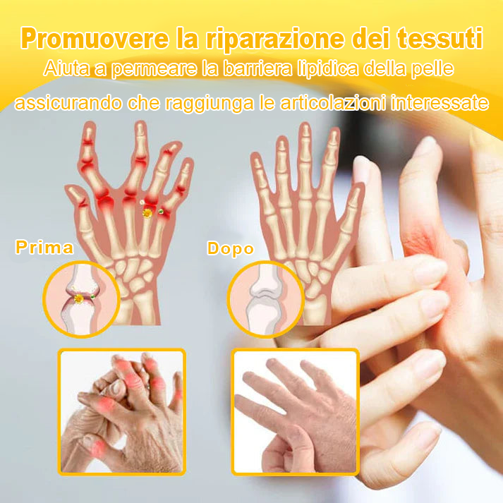 Cvreoz® Crema per il trattamento  delle articolazioni al veleno d'ape( ✨ Progettato appositamente per gli anziani & raccomandato da SIOT. ✨ )