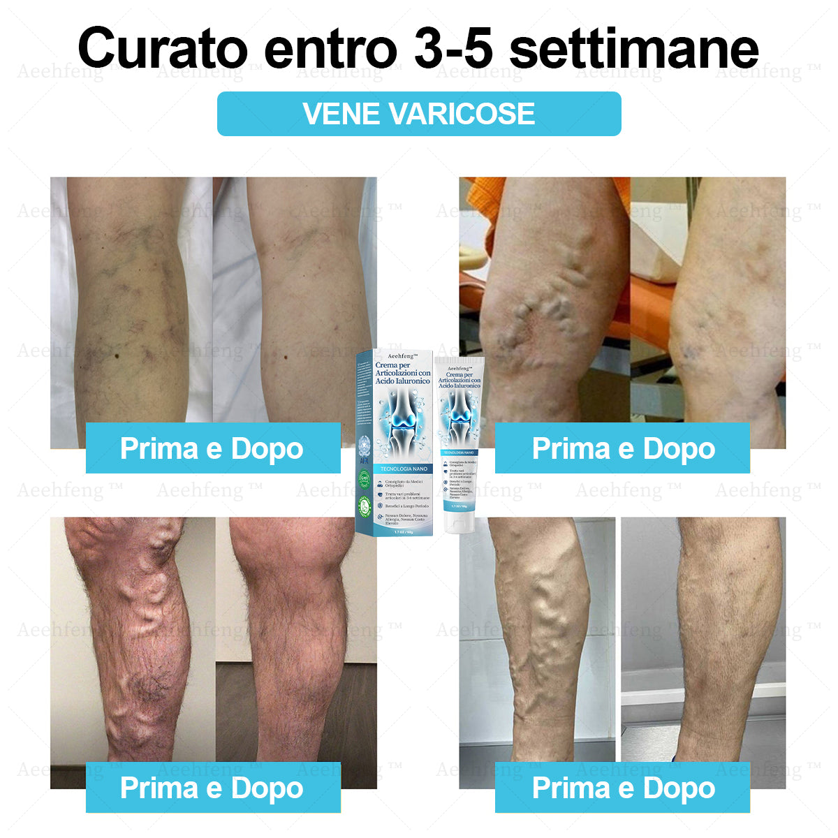 Aeehfeng™ Crema per la riparazione delle articolazioni con acido ialuronico(Trattamento completo per l'artrite, la nevralgia e i dolori muscolari🎄)