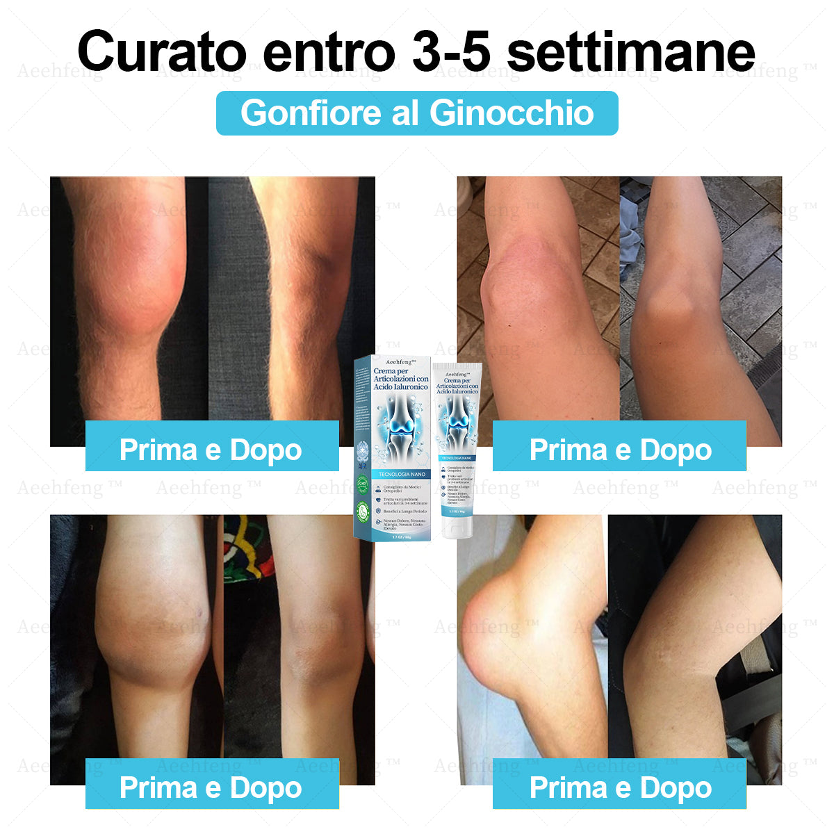 Aeehfeng™ Crema per la riparazione delle articolazioni con acido ialuronico(Trattamento completo per l'artrite, la nevralgia e i dolori muscolari🎄)