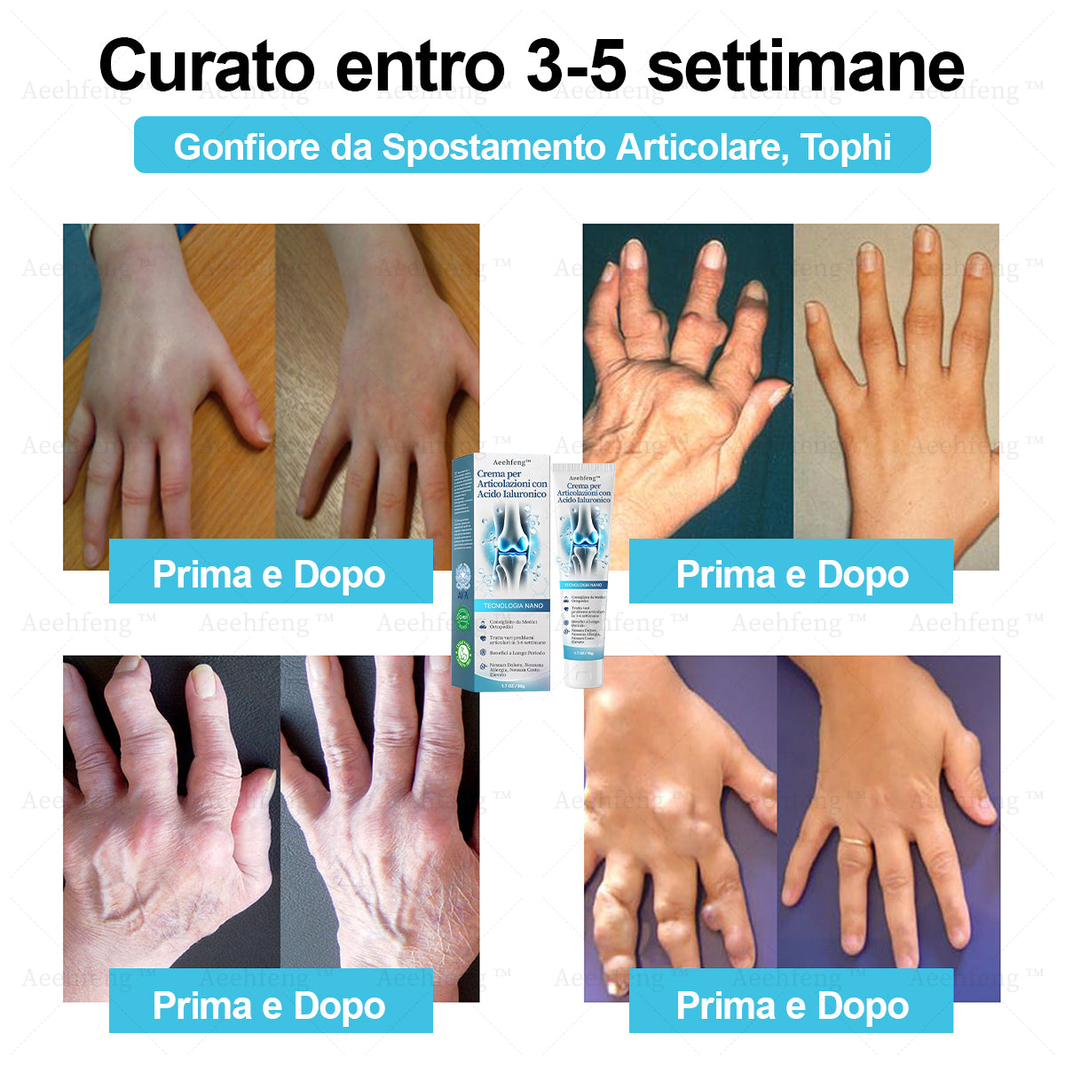 Aeehfeng™ Crema per la riparazione delle articolazioni con acido ialuronico(Trattamento completo per l'artrite, la nevralgia e i dolori muscolari🎄)