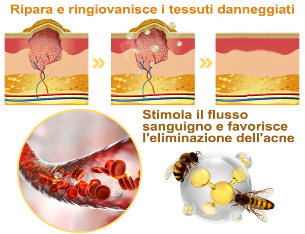 Zoencgz™ Crema Trattamento Pelle Potente per Tutto il Corpo 👩‍⚕️👩‍⚕️