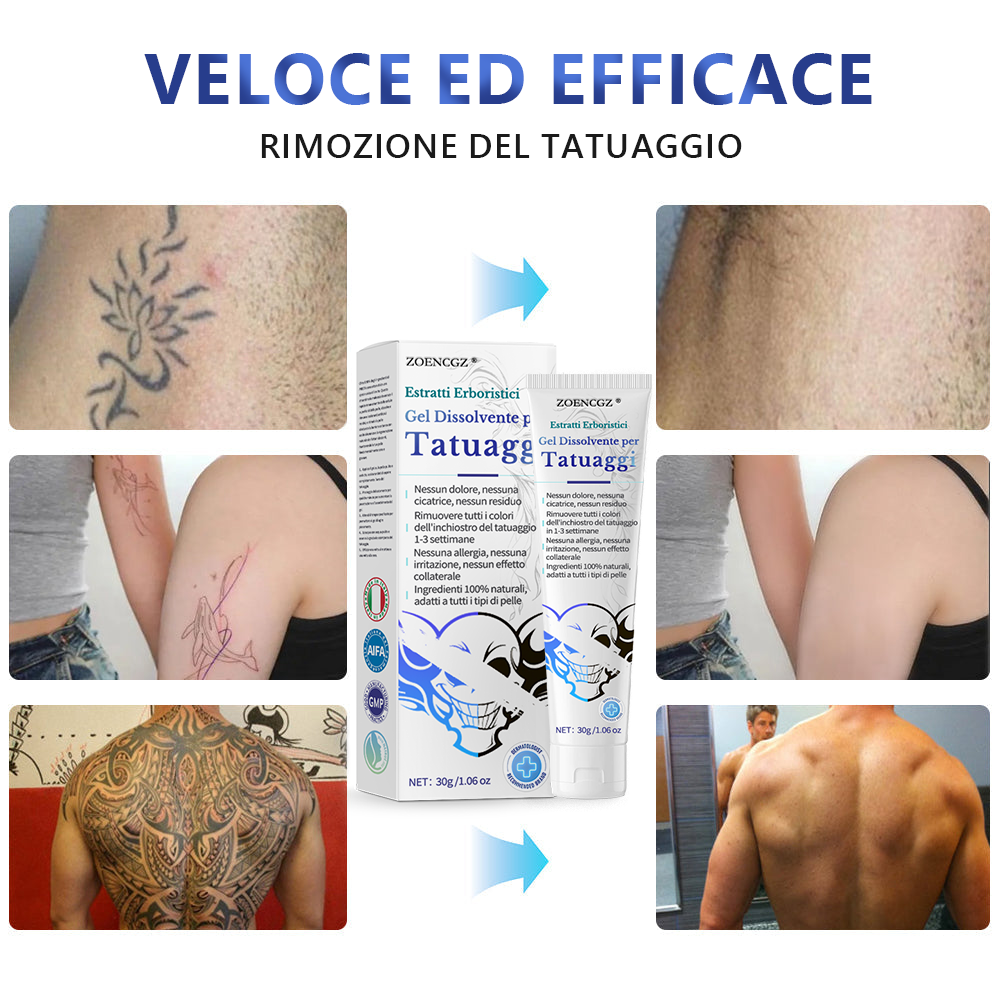 Sono rimaste solo 5 confezioni! Goditi uno sconto del 30%! I dermatologi consigliano di acquistare 4-6 confezioni per rimuovere completamente tutti i tatuaggi pigmentati. Non perdere questa occasione, altrimenti dovrai aspettare fino al prossimo anno!⏰⏰